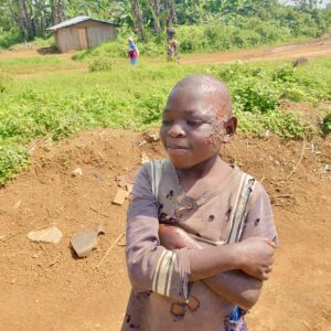 Soutenir un enfant épileptique dans la communauté pendant un mois